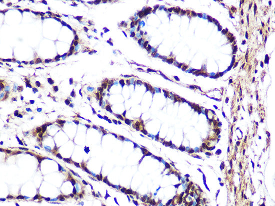 JNK1/JNK3 Rabbit mAb