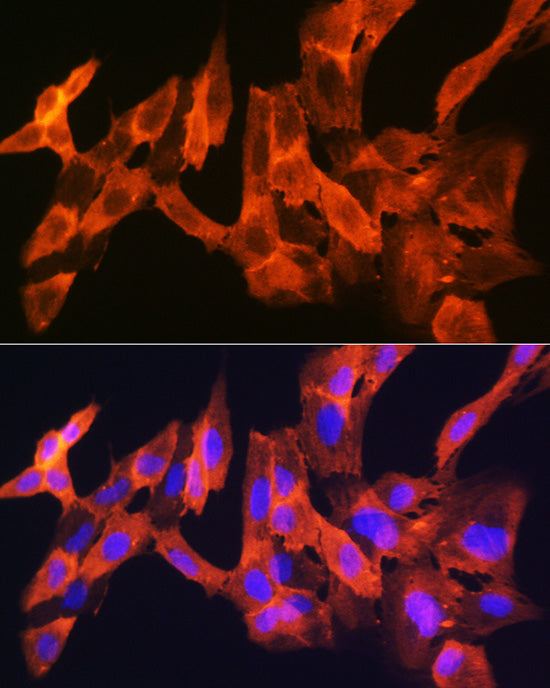 JNK1/JNK3 Rabbit mAb
