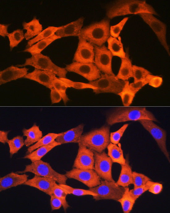JNK1/JNK3 Rabbit mAb