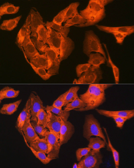 JNK1/JNK3 Rabbit mAb