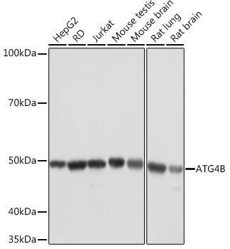 ATG4B Rabbit mAb