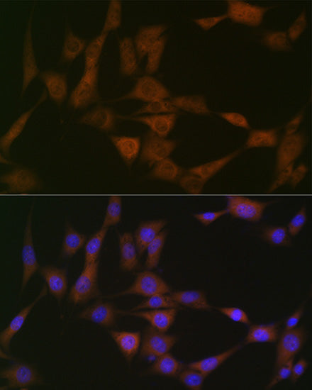 ATG4B Rabbit mAb