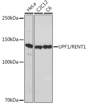UPF1/RENT1 Rabbit mAb
