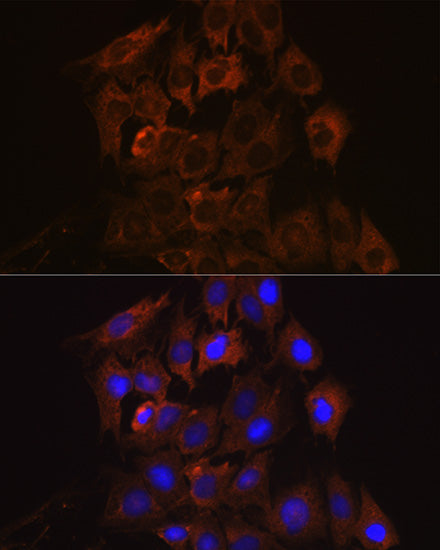UPF1/RENT1 Rabbit mAb