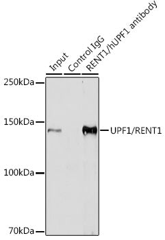 UPF1/RENT1 Rabbit mAb