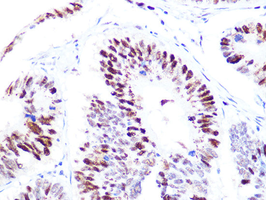 p60 CAF1 Rabbit mAb