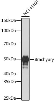 Brachyury Rabbit mAb