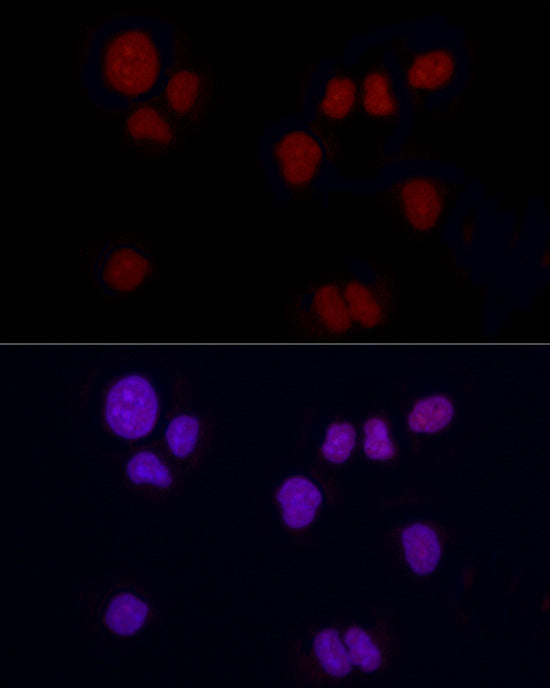 Brachyury Rabbit mAb