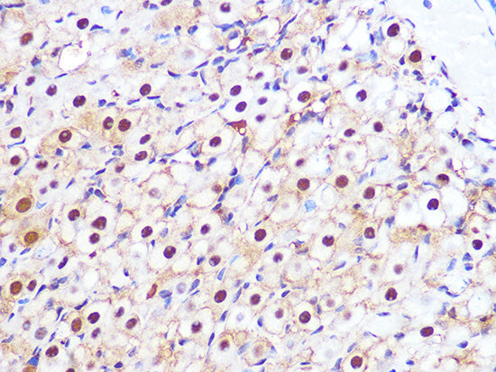 PSMA3 Rabbit mAb
