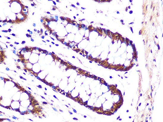 PSMA3 Rabbit mAb