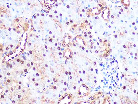 PSMA3 Rabbit mAb