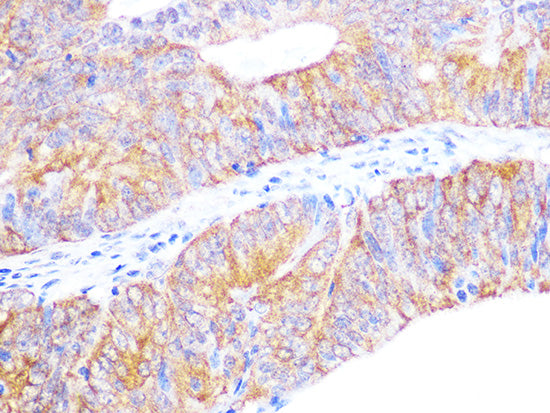 Cyclophilin 40 Rabbit mAb