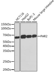 PAR2 Rabbit mAb