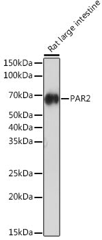 PAR2 Rabbit mAb