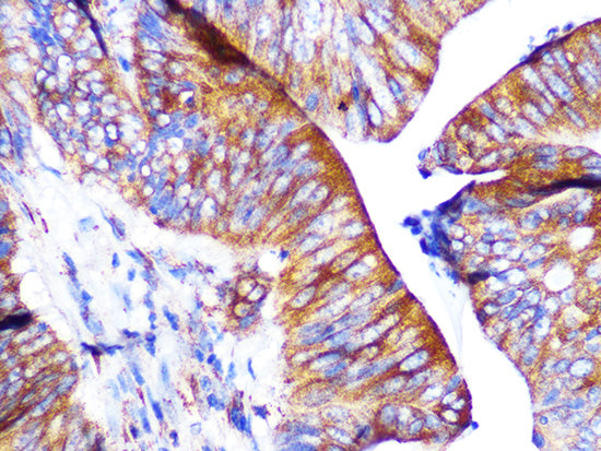 PAR2 Rabbit mAb