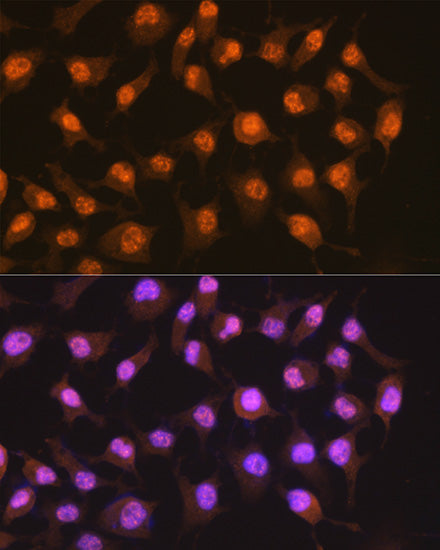 PER2 Rabbit mAb