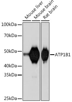 ATP1B1 Rabbit mAb