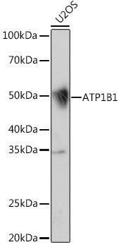 ATP1B1 Rabbit mAb