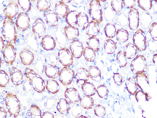 ATP1B1 Rabbit mAb