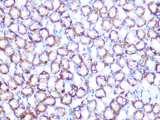ATP1B1 Rabbit mAb