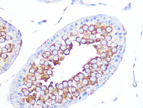 EBP1/PA2G4  Rabbit mAb