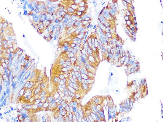 EBP1/PA2G4  Rabbit mAb