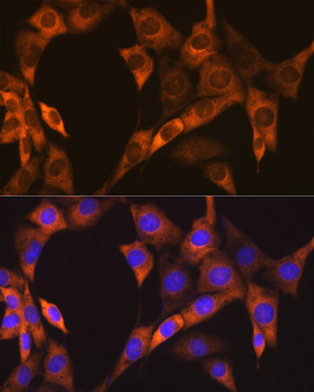 EBP1/PA2G4  Rabbit mAb