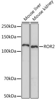 ROR2 Rabbit mAb
