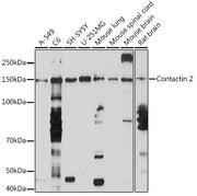 Contactin 2 Rabbit mAb