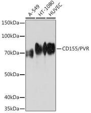 CD155/PVR Rabbit mAb