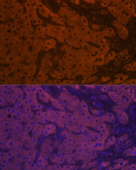 ApoM Rabbit mAb
