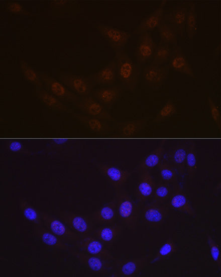 Rad23A Rabbit mAb