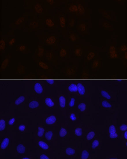 MBNL1 Rabbit mAb