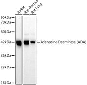 Adenosine Deaminase (ADA) Rabbit mAb