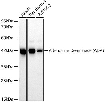 Adenosine Deaminase (ADA) Rabbit mAb