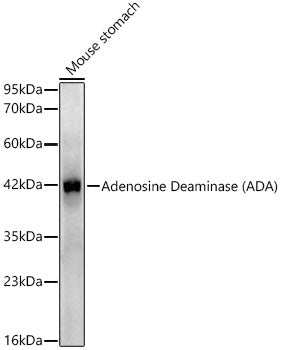 Adenosine Deaminase (ADA) Rabbit mAb