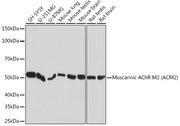 Muscarinic AChR M2 (ACM2) Rabbit mAb