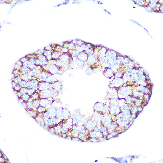 Muscarinic AChR M2 (ACM2) Rabbit mAb