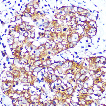 Muscarinic AChR M2 (ACM2) Rabbit mAb