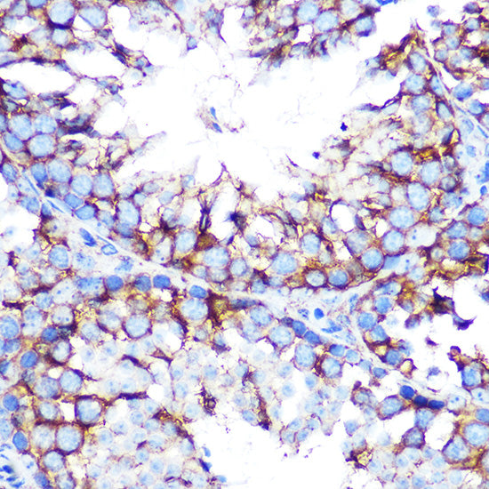 Muscarinic AChR M2 (ACM2) Rabbit mAb