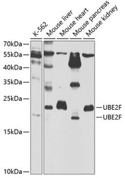 UBE2F Rabbit pAb