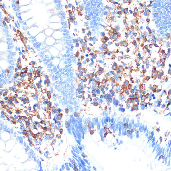 ELMO1 Rabbit mAb