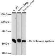 Thromboxane synthase Rabbit mAb