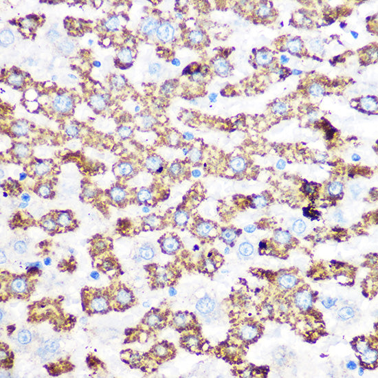 GLUD1 Rabbit mAb