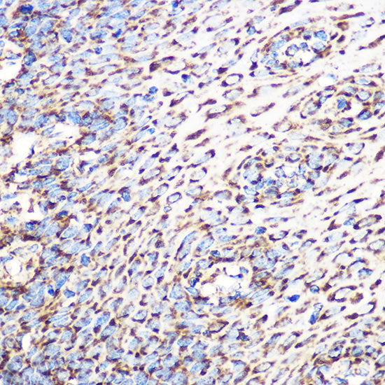 GLUD1 Rabbit mAb