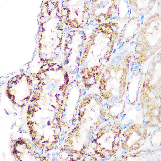 GLUD1 Rabbit mAb