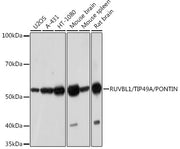 RUVBL1/TIP49A/PONTIN Rabbit mAb