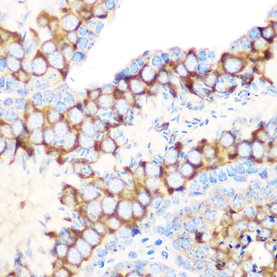 RUVBL1/TIP49A/PONTIN Rabbit mAb