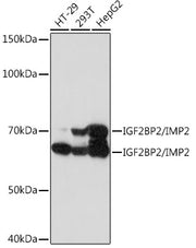 IGF2BP2/IMP2 Rabbit mAb