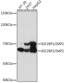 IGF2BP2/IMP2 Rabbit mAb